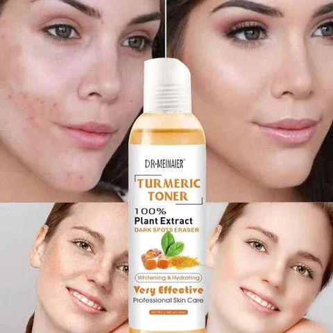 Dr. Meinaier - Turmeric Toner Whitening Hydrating Dark Spots Eraser