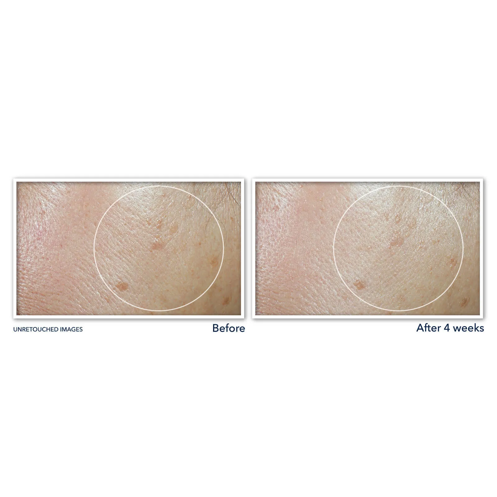 MULTI CORREXION® Even Tone   Lift Daily Moisturizer SPF 30