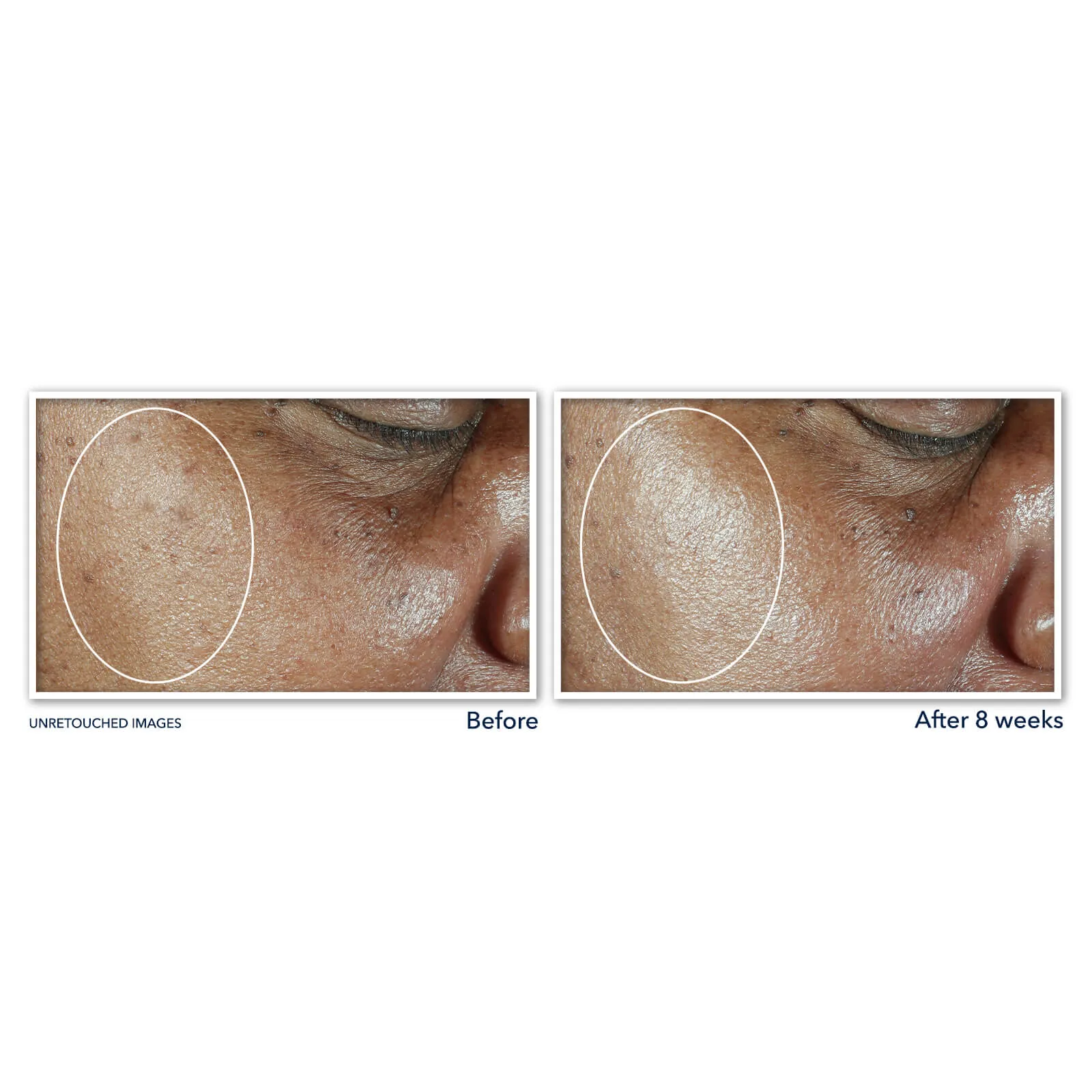 MULTI CORREXION® Even Tone   Lift Daily Moisturizer SPF 30